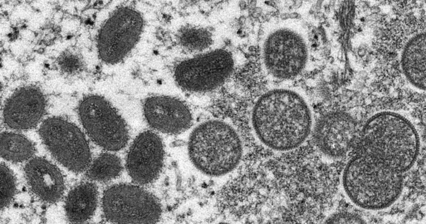 OMS volta a considerar a mpox, antiga varíola dos macacos, uma emergência de saúde global